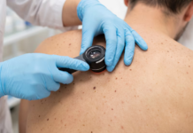 Avance contra el cáncer de piel: la primera vacuna logró resultados exitosos